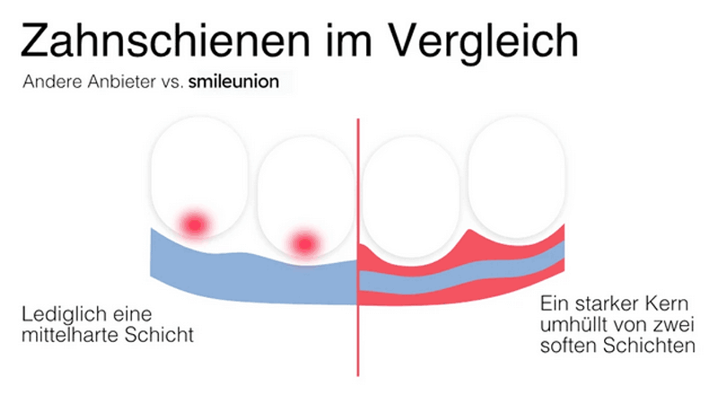 Grafik mit Vergleich von Zahnschienen von smileunion vs. andere Anbieter